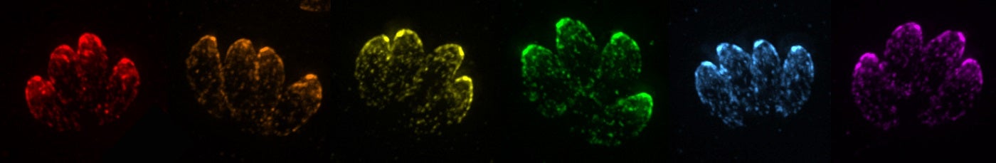 Tissue infected with the toxoplasmosis gondii parasite.