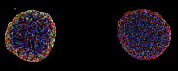 toxoplasma_gondii_cysts Toxoplasma gondii cysts in the transmissible form that reside inside neurons.